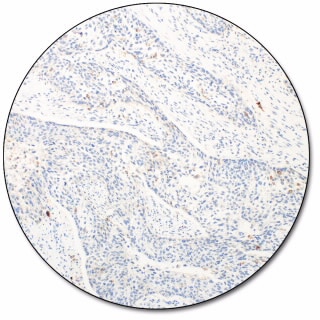 PD-L1 IHC 28-8 pharmDx for Autostainer Link 48